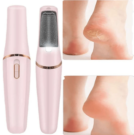 SmoothFeet – Pédicure Électrique Rechargeable 🦶✨