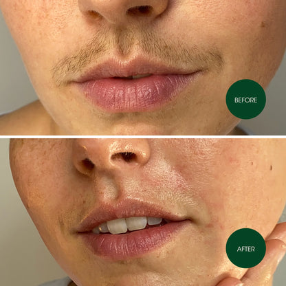 Bandes de cire visage liposolubles – Lot de 2 (1 acheté = 1 offert) — Douceur & précision | Beurre de karité | Peaux sensibles ✨🌸