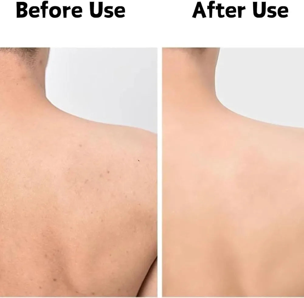 🛁✨ Serviette Exfoliante Douce & Antibactérienne 🙅🏿🦠  – LOT DE 2 – Peau Plus Lisse, Plus Saine, Plus Propre et Plus Lumineuse ✨ & Sans Impuretés 🌿💧