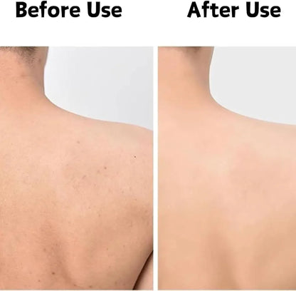 🛁✨ Serviette Exfoliante Douce & Antibactérienne 🙅🏿🦠  – LOT DE 2 – Peau Plus Lisse, Plus Saine, Plus Propre et Plus Lumineuse ✨ & Sans Impuretés 🌿💧