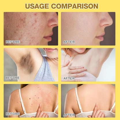 🍯🐝 Crème de Soin au Venin d’Abeille – Traitement Naturel des Verrues, Acrochordons, Imperfections Cutanées & Régénération de la Peau ✨🌿