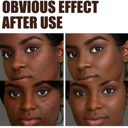 🧴 Crème au Rétinol grand format 50g - Anti-Âge – Anti-Rides –  Fermeté et Éclat — 🎁 Promos 1 acheté = 1 Offert