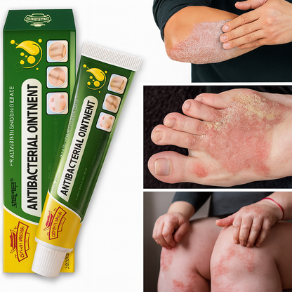 Lot de 3 Pommades pour psoriasis— Pommade naturelle à base de plantes, confort des peaux sujettes au psoriasis 🌿