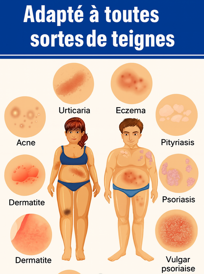 Lot de 3 Pommades pour psoriasis— Pommade naturelle à base de plantes, confort des peaux sujettes au psoriasis 🌿