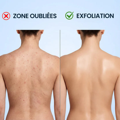 🛁✨ Serviette Exfoliante Douce & Antibactérienne 🙅🏿🦠  – LOT DE 2 – Peau Plus Lisse, Plus Saine, Plus Propre et Plus Lumineuse ✨ & Sans Impuretés 🌿💧